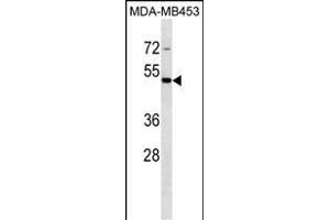 STAC Antibody (C-term) (ABIN1537013 and ABIN2849881) western blot analysis in MDA-M cell line lysates (35 μg/lane). (STAC antibody  (C-Term))