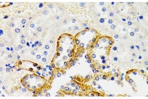 Immunohistochemistry of paraffin-embedded Rat kidney using SH2B1 Polyclonal Antibody at dilution of 1:100 (40x lens).