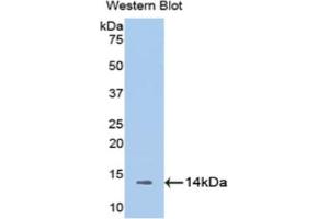 Western blot analysis of the recombinant protein. (Melatonin Receptor 1A antibody  (AA 216-257))
