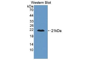 Figure. (ALDH2 antibody  (AA 59-150))