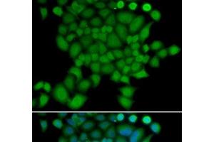Immunofluorescence analysis of U2OS cells using NEDD9 Polyclonal Antibody (NEDD9 antibody)