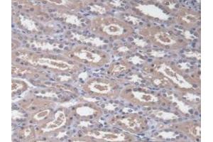 Detection of RDX in Human Kidney Tissue using Polyclonal Antibody to Radixin (RDX) (Radixin antibody  (AA 5-295))