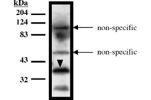 Western Blotting (WB) image for anti-HIR Histone Cell Cycle Regulation Defective Homolog A (HIRA) (AA 1-200), (N-Term) antibody (ABIN264454) (HIRA antibody  (N-Term))