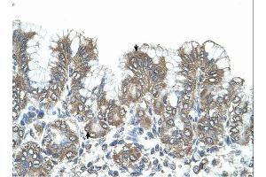SNF1LK antibody was used for immunohistochemistry at a concentration of 4-8 ug/ml. (SIK1 antibody  (N-Term))