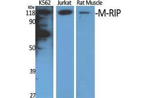 Western Blot (WB) analysis of specific cells using M-RIP Polyclonal Antibody. (MPRIP antibody  (Internal Region))