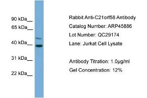 WB Suggested Anti-C21orf58  Antibody Titration: 0. (C21orf58 antibody  (N-Term))