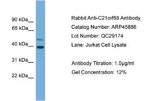 WB Suggested Anti-C21orf58  Antibody Titration: 0.