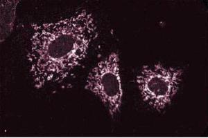 Immunofluoresence staining of NIH-3T3 cells. (Cortactin antibody)