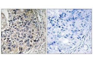 Immunohistochemistry (IHC) image for anti-Solute Carrier Family 25 (Mitochondrial Carrier, Aralar), Member 12 (Slc25a12) (Internal Region) antibody (ABIN1850956)