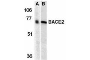 Western blot analysis of BACE2 in human (A) and mouse (B) heart tissue lysates with AP30112PU-N BACE2 antibody at 1 μg/ml. (BACE2 antibody  (N-Term))