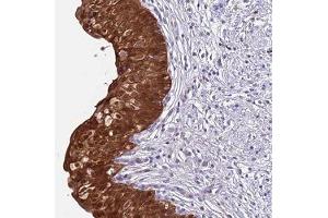 Immunohistochemical staining of human urinary bladder with C6orf47 polyclonal antibody ( Cat # PAB28310 ) shows strong cytoplasmic, nuclear and membranous positivity in urothelial cells at 1:1000 - 1:2500 dilution. (C6orf47 antibody)