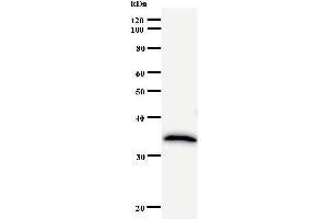Western Blotting (WB) image for anti-Zinc Finger Protein 44 (ZNF44) antibody (ABIN931076) (Zinc Finger Protein 44 antibody)