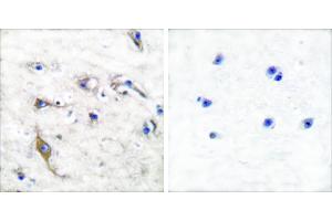 Peptide - +Immunohistochemical analysis of paraffin-embedded human brain tissue using JM4 antibody (#C0238).