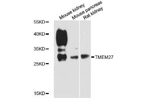Western blot analysis of extracts of various cell lines, using TMEM27 antibody (ABIN6292811) at 1:3000 dilution.