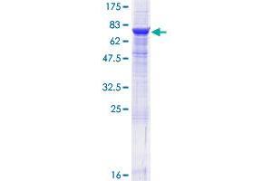 Image no. 1 for Ectonucleoside Triphosphate diphosphohydrolase 1 (ENTPD1) (AA 1-510) protein (GST tag) (ABIN1352838)