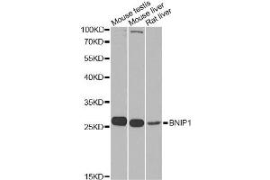 Western blot analysis of extracts of various cell lines, using BNIP1 Antibody. (BNIP1 antibody)