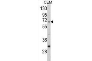 Western Blotting (WB) image for anti-Mitochondrially Encoded NADH Dehydrogenase 5 (MT-ND5) antibody (ABIN3002895) (MT-ND5 antibody)
