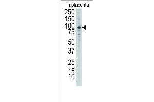 Western Blotting (WB) image for anti-Discoidin Domain Receptor tyrosine Kinase 1 (DDR1) (AA 17-47), (N-Term) antibody (ABIN392014)