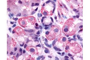 Anti-HRH2 / Histamine H2 Receptor antibody IHC of human stomach, parietal cells. (HRH2 antibody  (Cytoplasmic Domain))