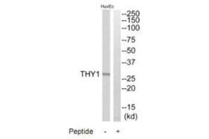 Western blot analysis of extracts from HuvEc cells, using THY1 antibody. (CD90 antibody)