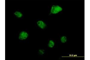 Immunofluorescence of purified MaxPab antibody to RBM6 on HeLa cell. (RBM6 antibody  (AA 1-601))