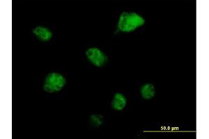 Immunofluorescence of purified MaxPab antibody to RBM6 on HeLa cell.