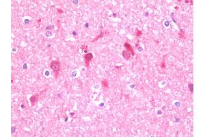 Anti-UFD2A / UBE4B antibody IHC staining of human brain, cortex. (UBE4B antibody  (AA 869-1179))