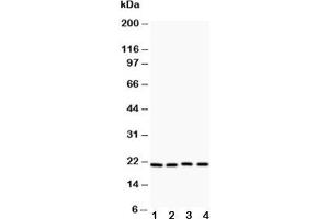 Western blot testing of Caveolin-1 antibody and Lane 1:  HeLa;  2: HT1080;  3: human placenta;  4: A431 (Caveolin-1 antibody  (AA 4-178))