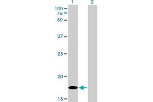Western Blot analysis of MCFD2 expression in transfected 293T cell line by MCFD2 monoclonal antibody (M01), clone 3A5-G4. (MCFD2 antibody  (AA 1-146))
