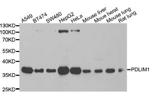 Western blot analysis of extracts of various cell lines, using PDLIM1 antibody (ABIN5974031) at 1/1000 dilution. (PDLIM1 antibody)