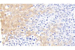 Detection of CALPRO in Human Tonsil Tissue using Polyclonal Antibody to Calprotectin (CALPRO) (S100A8/A9 Complex (Calprotectin) antibody  (AA 1-114))