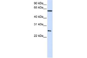 CCT7 antibody used at 1 ug/ml to detect target protein.