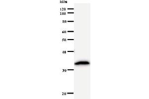 Western Blotting (WB) image for anti-Proteasome (Prosome, Macropain) 26S Subunit, ATPase, 5 (PSMC5) antibody (ABIN933121) (PSMC5 antibody)