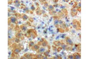 Used in DAB staining on fromalin fixed paraffin- embedded Kidney tissue (Angiostatin antibody  (AA 98-436))