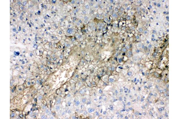 Hemoglobin Alpha 1 + 2 (HBA1,HBA2) (AA 2-142) antibody