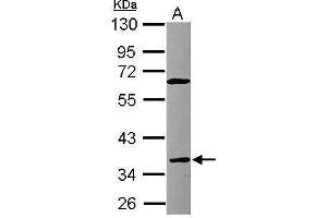 WB Image Sample (30 ug of whole cell lysate) A: Raji 10% SDS PAGE antibody diluted at 1:1000 (FCER2 antibody  (Center))