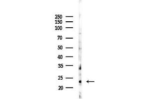 Western blot analysis of lysates from Mouse testis, using TRAPPC5 Antibody at 1/1000 dilution.