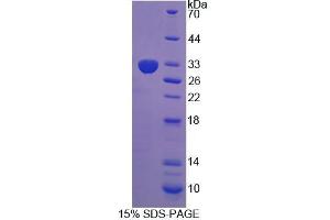 Image no. 1 for Leucine Rich Repeats And Death Domain Containing Protein (AA 668-917) protein (His tag) (ABIN4989368) (Leucine Rich Repeats And Death Domain Containing Protein (AA 668-917) protein (His tag))