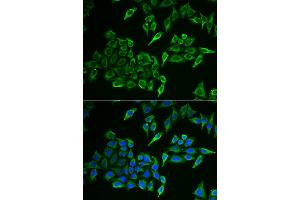 Immunofluorescence analysis of HeLa cells using COX4I1 antibody (ABIN5973942). (COX IV antibody)