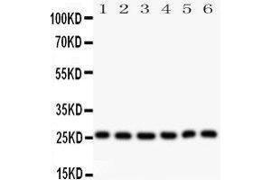 Observed bind size: 26KD (Galectin 3 antibody  (AA 139-250))