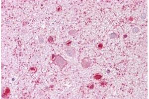 Anti-MCM3 antibody IHC staining of human brain, cortex. (MCM3 antibody  (AA 696-745))