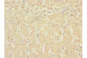 Immunohistochemistry of paraffin-embedded human liver tissue using ABIN7168232 at dilution of 1:100 (RCHY1 antibody  (AA 1-261))