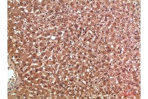 Immunohistochemical analysis of paraffin-embedded human-liver, antibody was diluted at 1:200 (MBL2 antibody  (AA 21-70))
