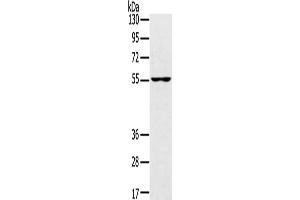 Western Blotting (WB) image for anti-Upstream Binding Protein 1 (LBP-1a) (UBP1) antibody (ABIN2433293) (UBP1 antibody)