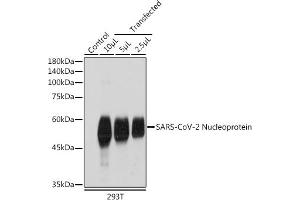 Western blot analysis of extracts of normal 293T cells and 293T transfected with Nucleoprotein,using SARS-CoV-2 Nucleoprotein antibody (ABIN7269053) at 1:1000 dilution. (Nucleoprotein antibody)