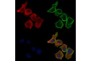 ABIN6260777 and ABIN6277148 staining HepG2 cells by IF/ICC.