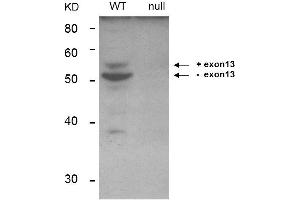Western Blot of Anti-BIN1 Antibody. (BIN1 antibody)