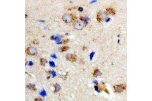 Immunohistochemical analysis of OSGEPL1 staining in rat brain formalin fixed paraffin embedded tissue section. (OSGEPL1 antibody)