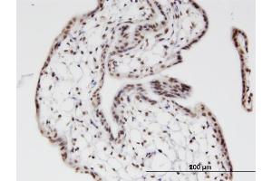 Immunoperoxidase of monoclonal antibody to ZNF397 on formalin-fixed paraffin-embedded human placenta. (ZNF397 antibody  (AA 131-230))