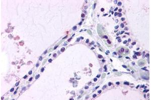 Thyroid, Human: Formalin-Fixed, Paraffin-Embedded (FFPE) (LPCAT1 antibody  (Internal Region))